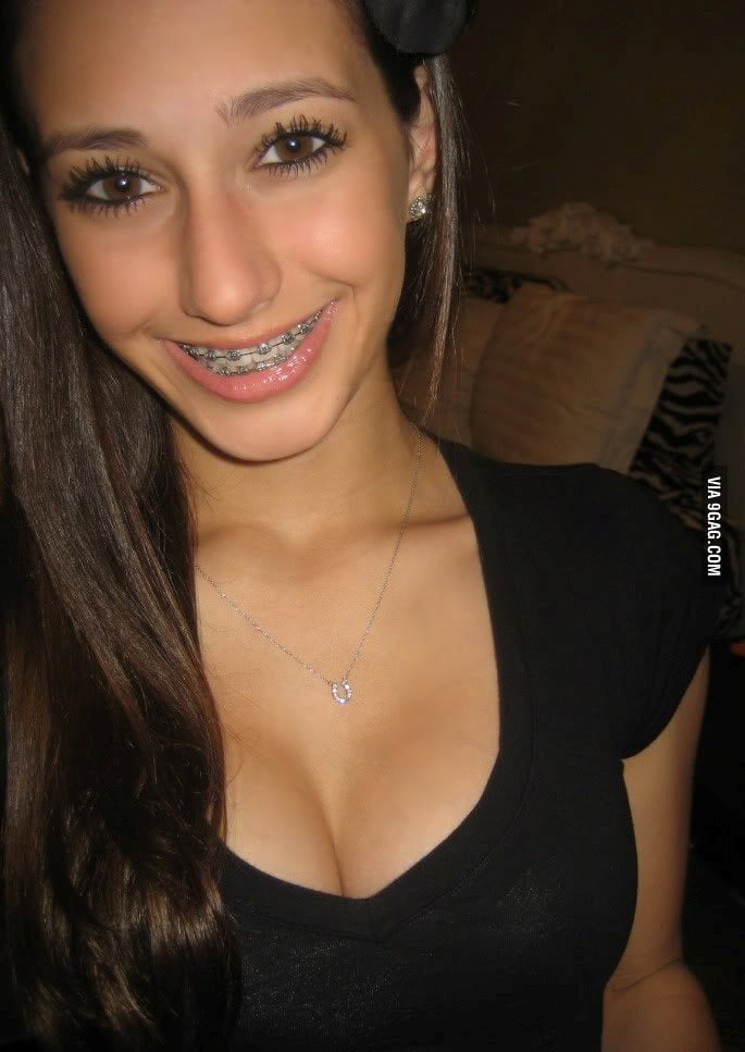 with braces captions Bikini girls