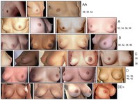 chart Nude breast